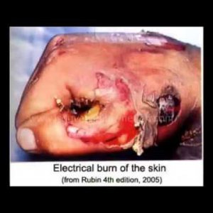 Elektrik İş Kazaları Yaralanmaların Derlendiği İbretlik Bir Çalışma - YouTube